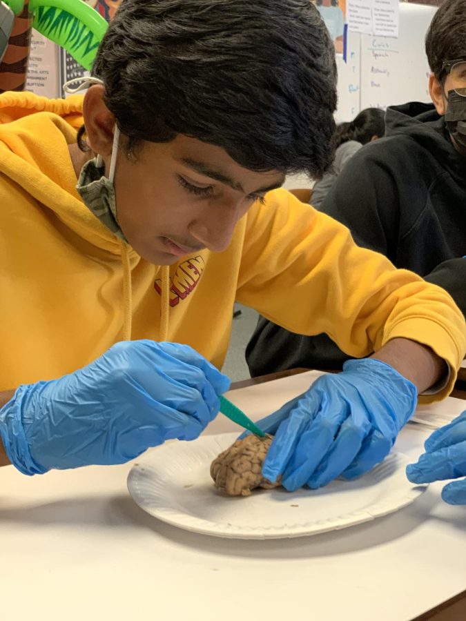 Arya Yalamanchi (24) carefully makes his first incision into the brain.